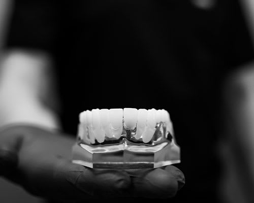Dental Implants, Swift Current Dentist